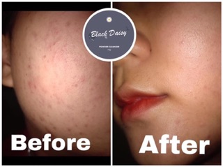 Combo 3 bột rữa mặt + xẻng múc bột