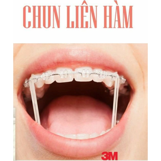 CHUN LIÊN HÀM 3M- THUN NIỀNG RĂNG NHA KHOA