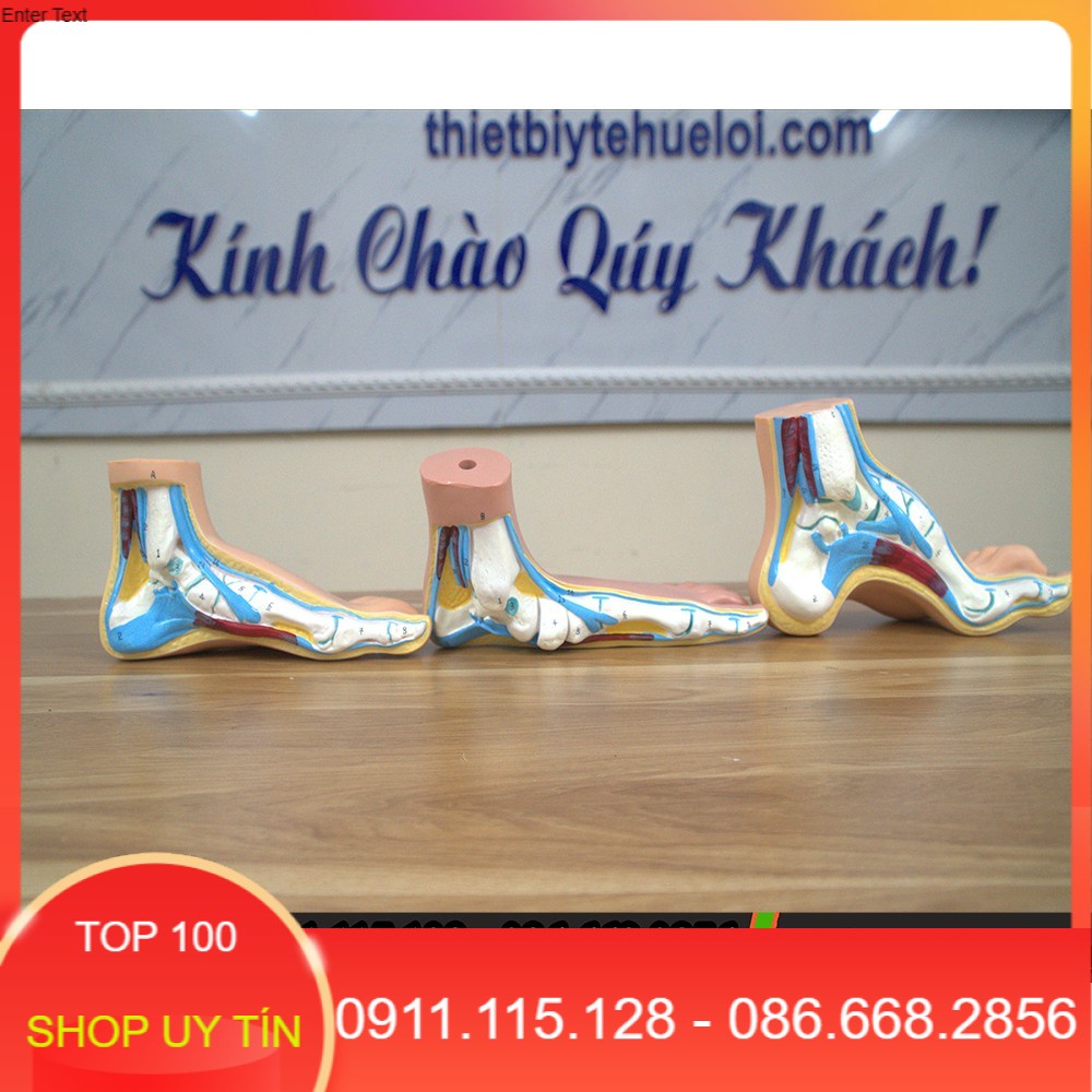 Bộ mô hình bàn chân của người bị tiểu đường