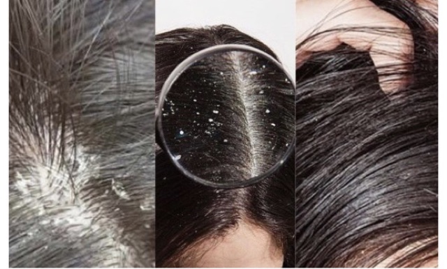 [+Tặng mũ trùm] Dầu gội hỗ trợ trị rụng, gàu, dầu nhờn chuyên sâu Nouvelle Kapillixine Ý Energy, Clean Sense, Cleanser