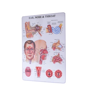 Tranh tranh tai mũi họng , tranh nhựa cứng tráng gương cao cấp, Tranh giải phẫu tai mũi họng
