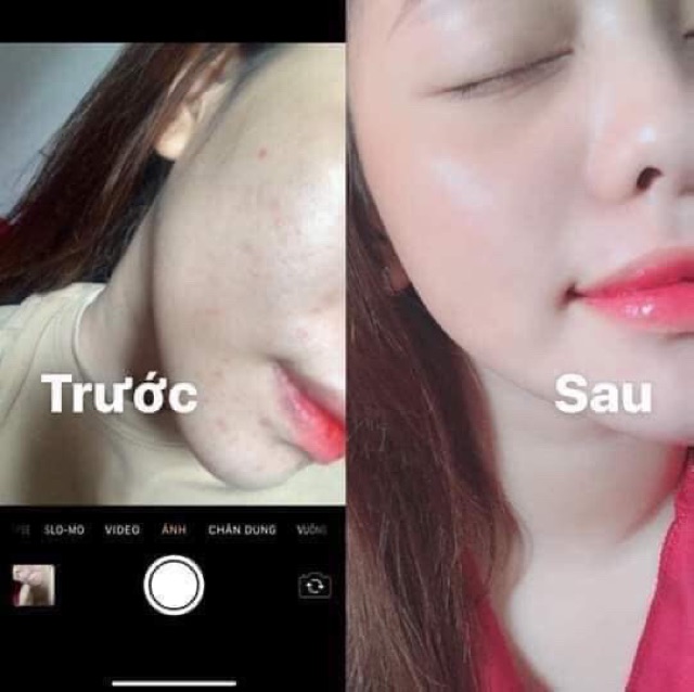 Kem Demejine Hàn Quốc