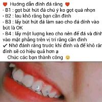 Đá đính răng lẻ 1 viên