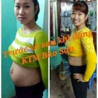 Kem tan mỡ bảo sơn