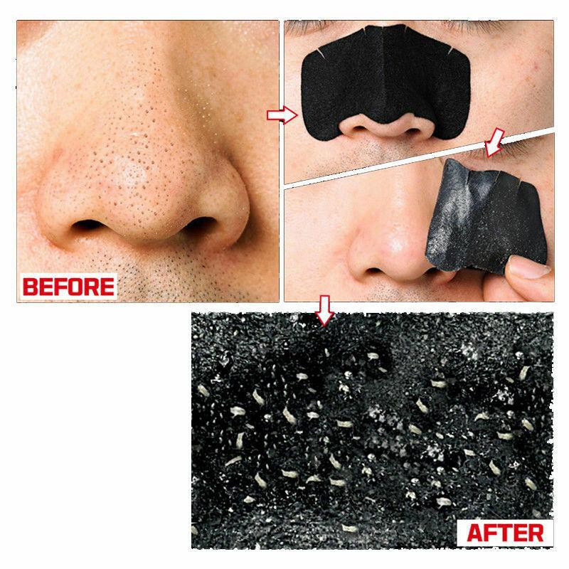 Miếng dán lột mụn đầu đen 3 bước Hàn Quốc Holika Holika Pig Nose Strong siêu sạch làm dịu da kháng khuẩn 3g