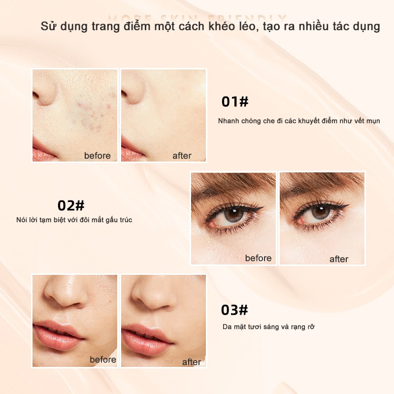 Mistine Kem che khuyết điểm mụn thâm dung tích 7.5ml