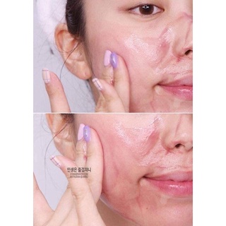 Tinh Chất Red Peel Tingle Serhm So Natural