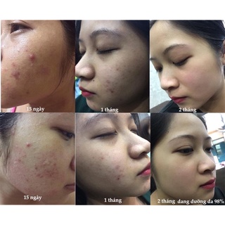 Kem dưỡng Bạch hồng đơn