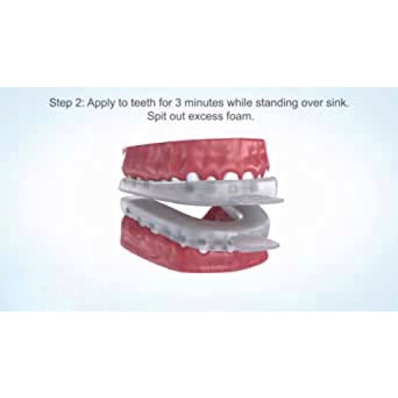 WhiteFoam Leblanc làm sạch máng chỉnh nha trong suốt như Invisalign