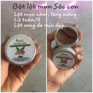 Bột lột mụn cacao Sóc Con