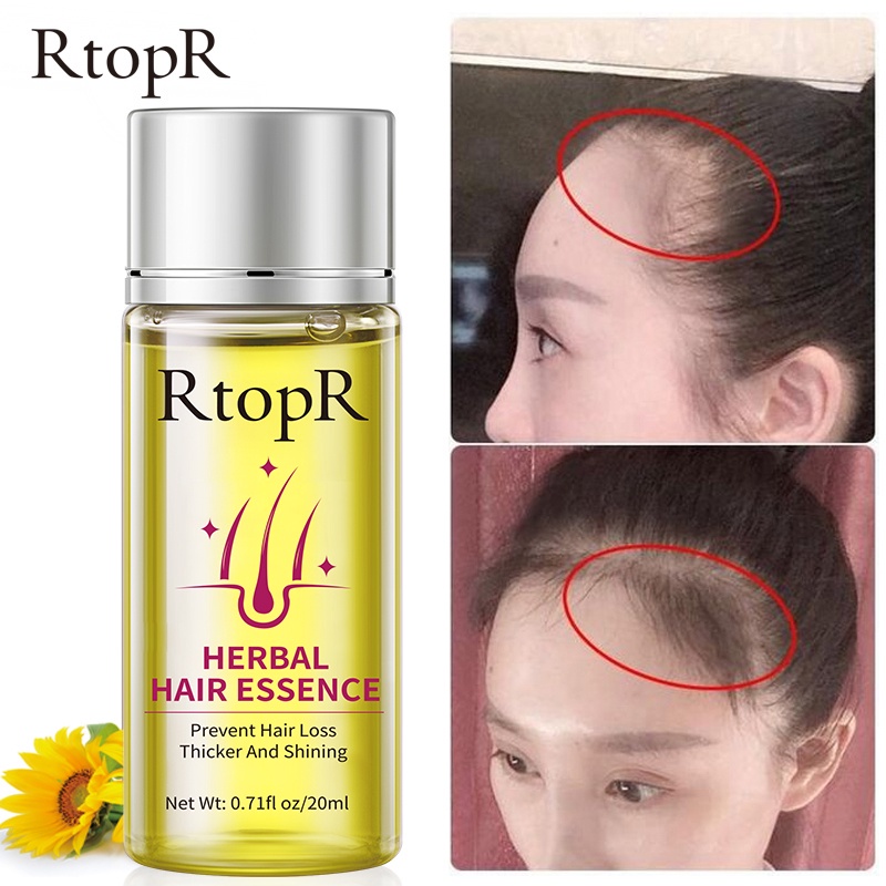 RtopR bộ chăm sóc tóc：Dầu gội thảo dược RtopR 20ml + RtopR Moroccan Hair Oil 35ml