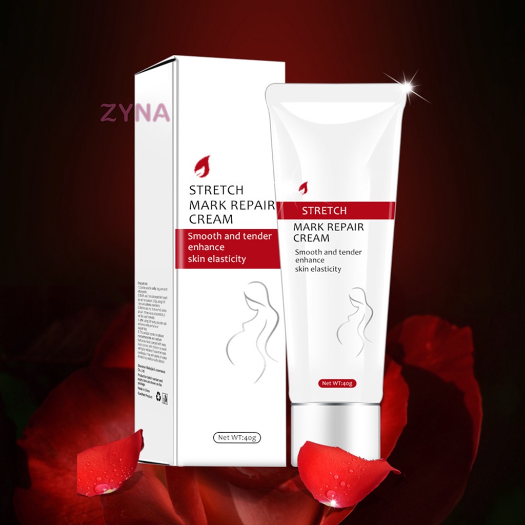 Kem Hỗ trợ giảm rạn da không gây kích ứng cho phụ nữ mang thai 40ml
 | BigBuy360 - bigbuy360.vn