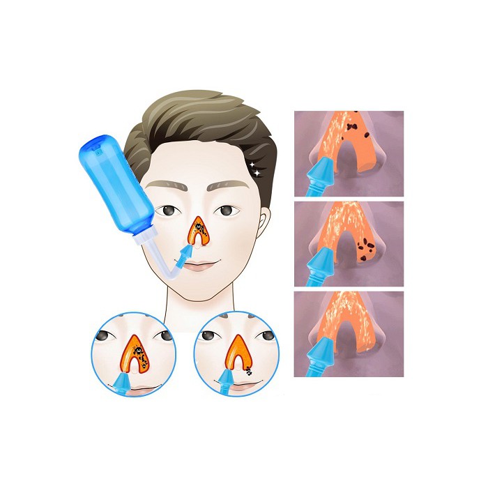 [HCM] Bình rửa mũi cho bé và cả gia đình DHS6332