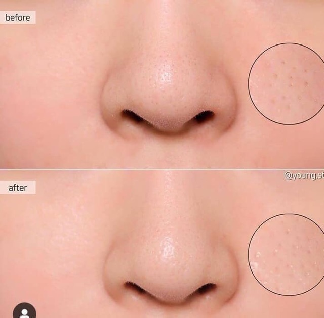 Nước thần Estee Lauder Micro Essence Skin Activating 30ml