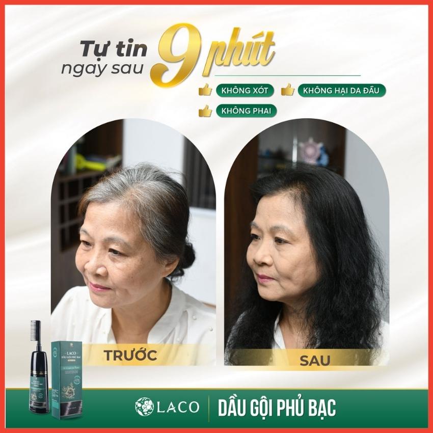 Dầu gội phủ bạc Laco, dầu gội phủ bạc thảo dược Laco Black Hair 200ml - Gội Là Đen Nhuộm Tóc Tự Tin Sau 9 Phút