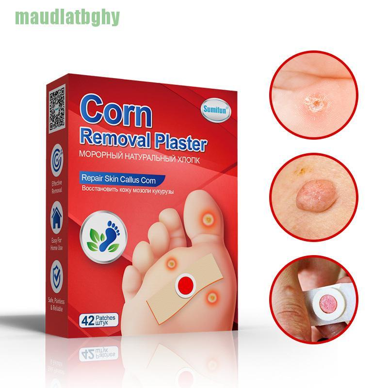 (Hàng Mới Về) Set 42 Miếng Dán Trị Mụn Cóc Dành Cho Bàn Chân