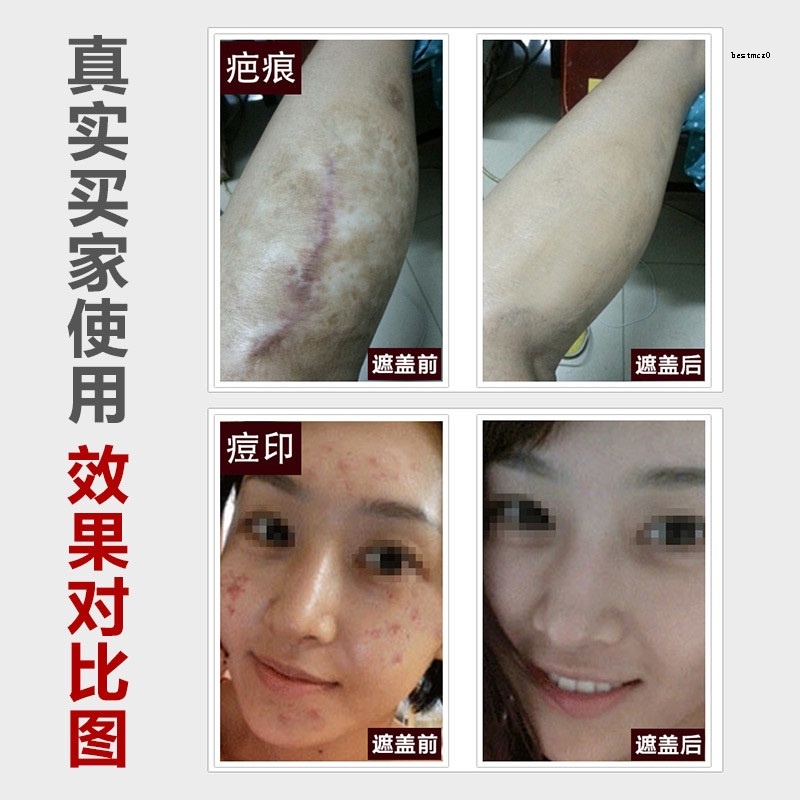 Kem Dưỡng Da Tay Giúp Làm Trắng Da Và Chống Thấm Nước Hiệu Quả¤Kem Che Khuyết Điểm Technique Scar Cream Dạng Sáp Dán Mạnh Mẽ Và Vô Hình Mặc Trong Nhà Cho Nam Nữ Giới Mặc Tại Nhà