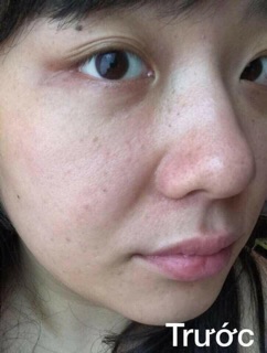 Kem duỡng Vento pearl