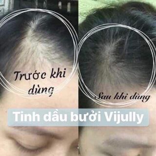 XỊT BƯỞI VIJULLY Dưỡng Tóc Mẫu Mới