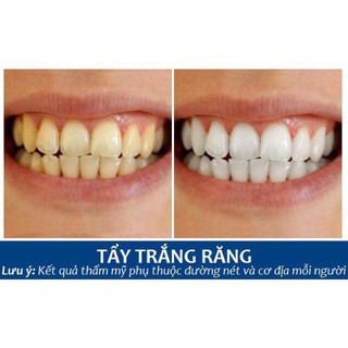 Bút tẩy trắng răng Dazzling White