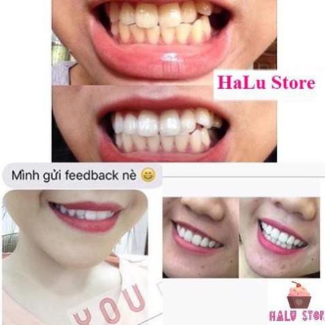 445566 Combo 14 miếng (7 gói/7 ngày) dán trắng răng Crest 3D White Whitestrips loại Professional Effects - Mỹ bopster