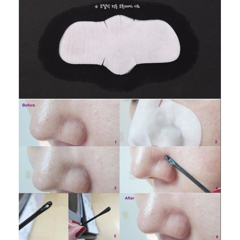 Miếng Giảm Mụn Đầu Đen Ciracle Goodbye Blackhead