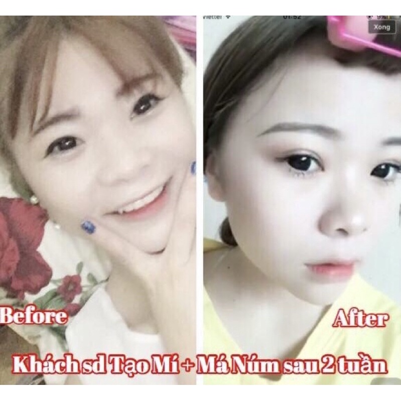 Tinh chất Miracle Pháp tạo mắt 2 mí, mở tròng mắt siêu hiệu quả