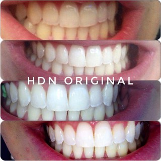 Lẻ Miếng dán Crest 3D whitestrips Professional Effects Teeth Whitening Strips