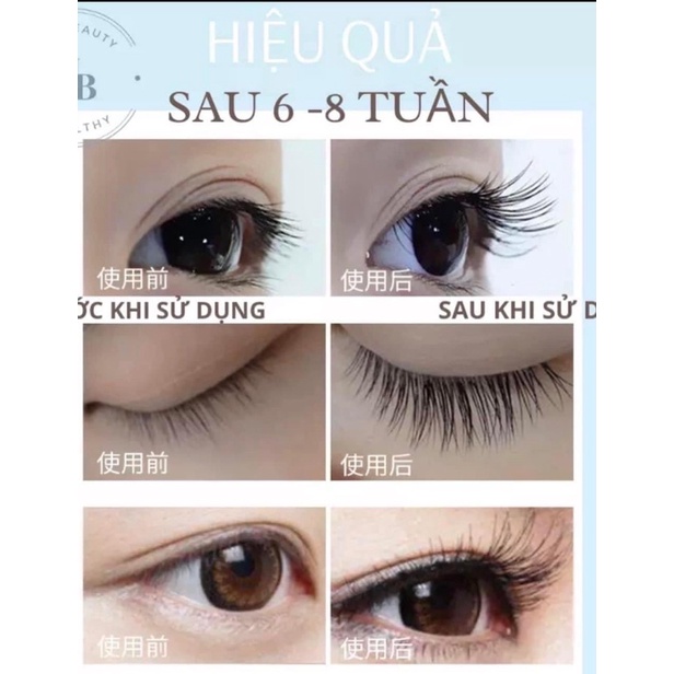 Serum dưỡng mi xiuse - mọc dài dày - có feedback