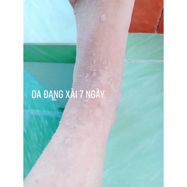 500gr kem body bong da tái tạo