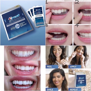 ( 2 hàm -1 lần dán) (Miếng dán trắng răng Crest 3D Whitestrips Supreme Bright