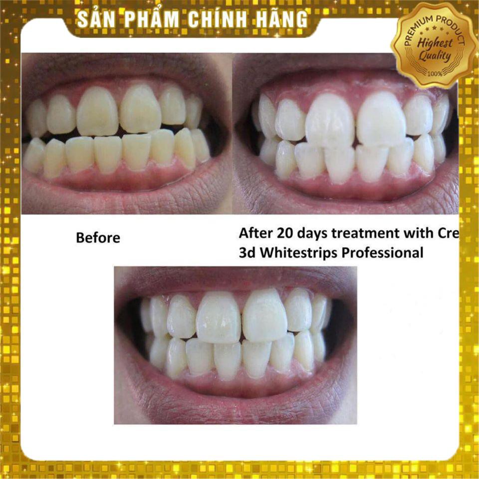 🦷 Combo 20 miếng dán trắng răng + đèn chiếu Crest 3D White Whitestrips with Light - Liệu trình 10 ngày🦷