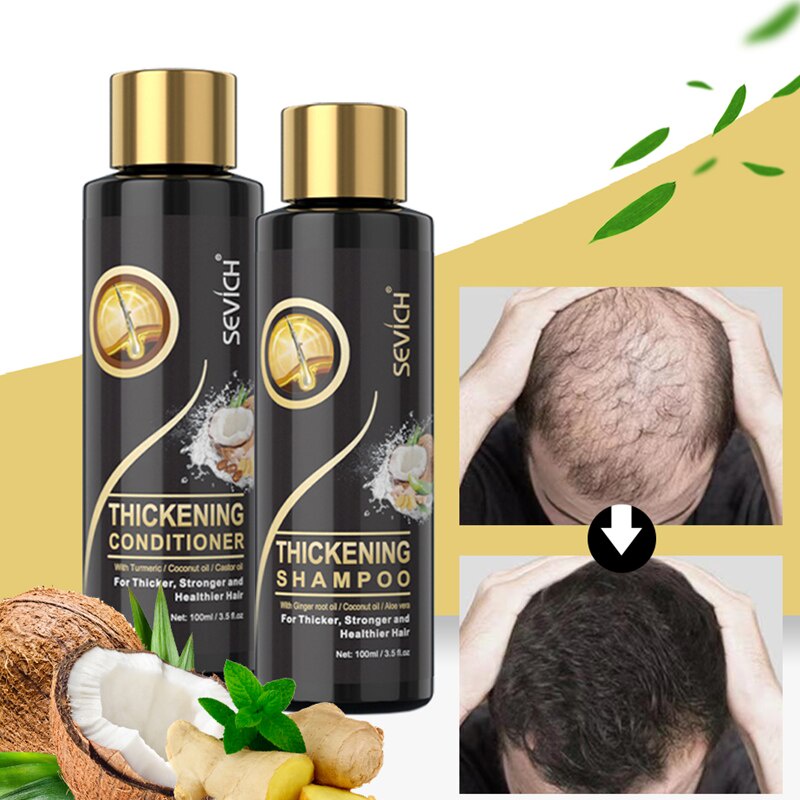 Dầu gội/dầu xả Sevich 100ml dưỡng ẩm ngăn ngừa rụng tóc hiệu quả