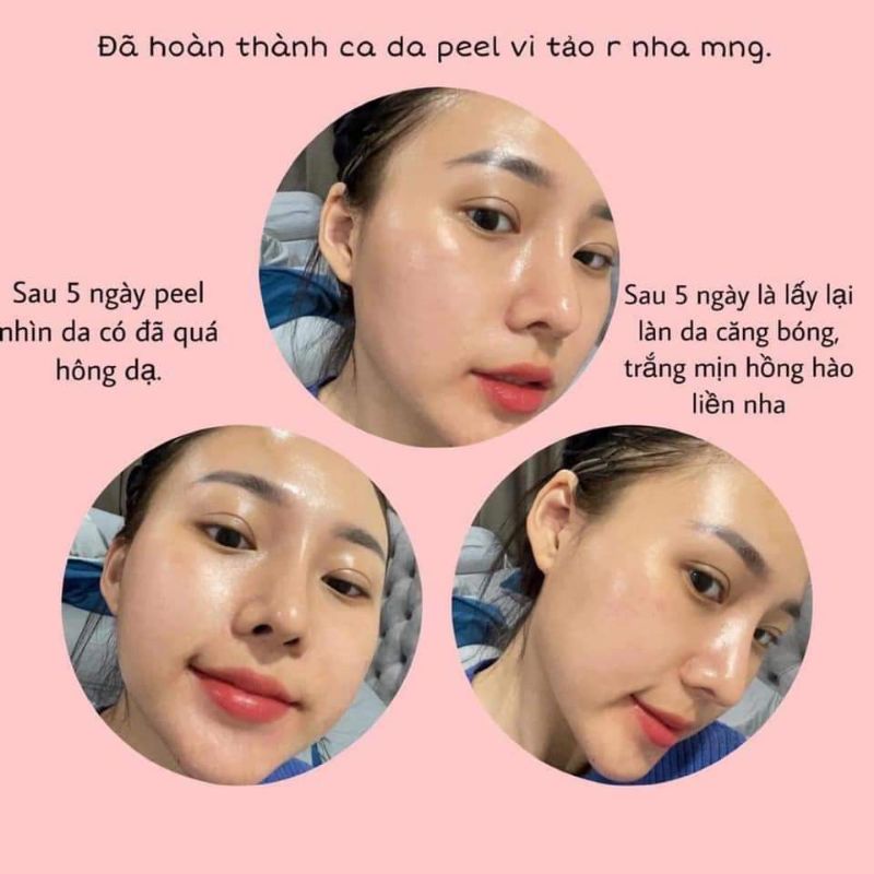 Peel da Vi Tảo Retinol LE'PEAU tặng kèm serum B5 và Ance serum diếp cá ⚡ Freeship ⚡