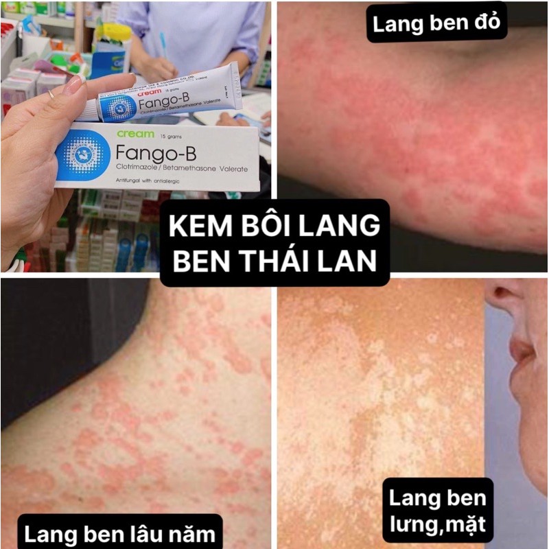 KEM BÔI LANG BEN  THÁI LAN