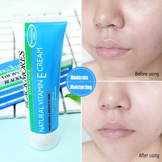 🔥 kem dưỡng da mặt chứa vitamin e giúp dưỡng ẩm hiệu quả
