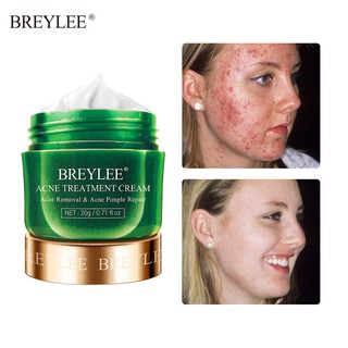Kem Hỗ Trợ Giảm mụn da mặt BREYLEE 20g
