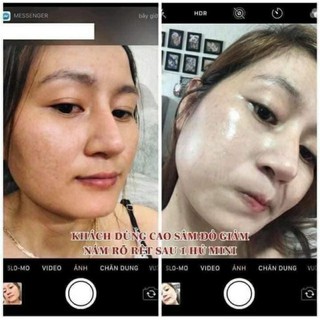 CAO MỤN SÂM ĐỎ 36 VỊ