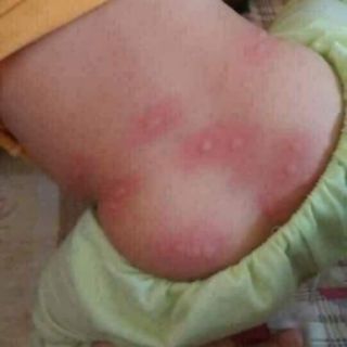 Đèn tinh dầu  ĐUỔI MUỖI
