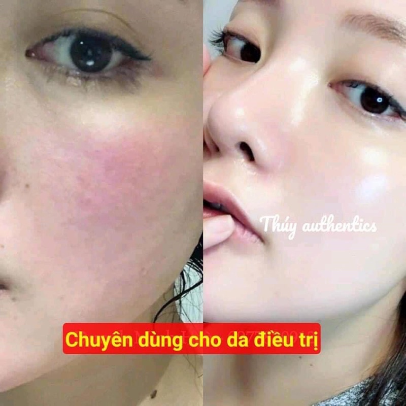 MẶT NẠ TINH CHẤT HÀN QUỐC HỘP 10m