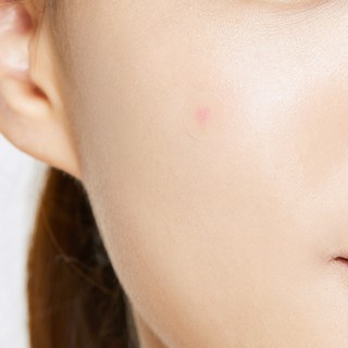 Miếng Dán Mụn COSRX Acne Pimple Master Patch 24 miếng/ gói