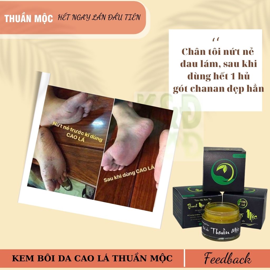 Cao Lá Thuần Mộc Bôi Da Dưỡng Ẩm Làm Dịu Da Mờ Sẹo 30g