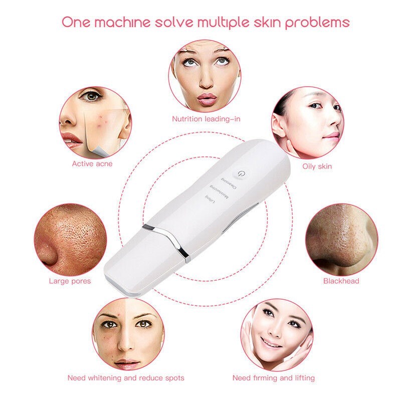 Máy Sủi Da Cà Da Làm Sạch Sâu Da Mặt Ultrasonic SunQueen Rung Sóng Âm ion Giúp Phục Hồi Collagen Cho Da