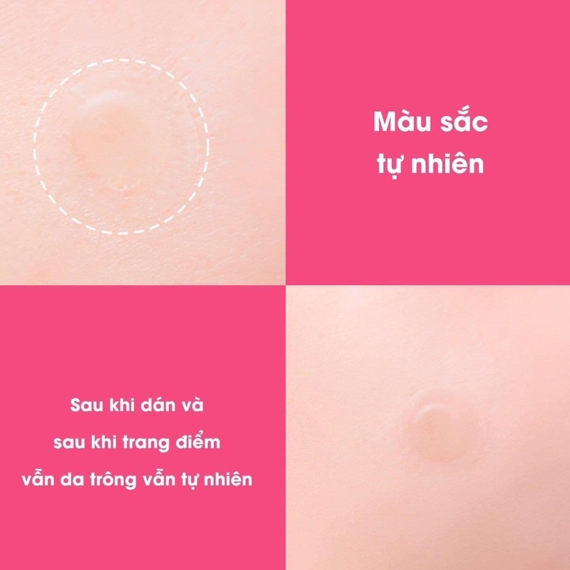 Miếng Dán Mụn Neogen Giảm Sưng Ngăn Sẹo Thâm  Dermalogy A-Clear Soothing Clear Spot Patch - Khongcoson