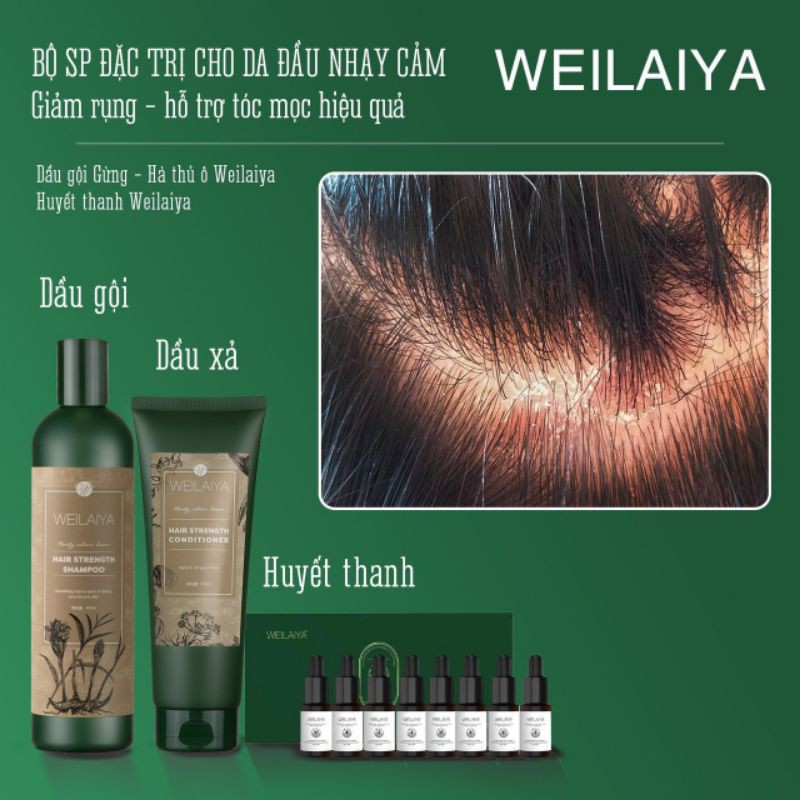 Dầu Gội Xả Gừng Weilaiya Ngăn Rụng, Giúp Mọc Tóc, Nuôi Dưỡng Tóc Óng Mượt