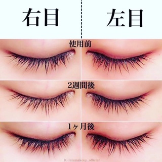 Dưỡng mi EMAKED