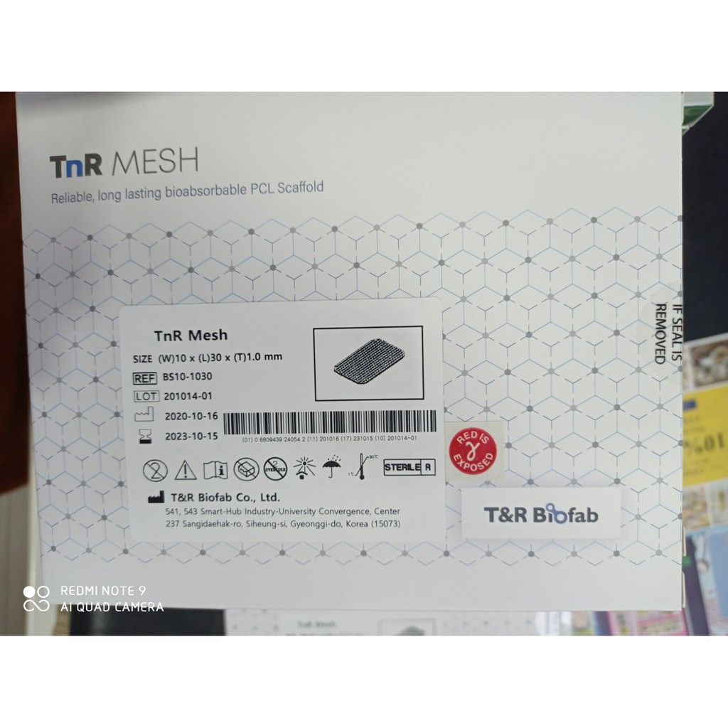 Trụ Vách Ngăn Mũi T&R MESH: DỰNG TRỤ - MỞ RỘNG VÁCH NGĂN