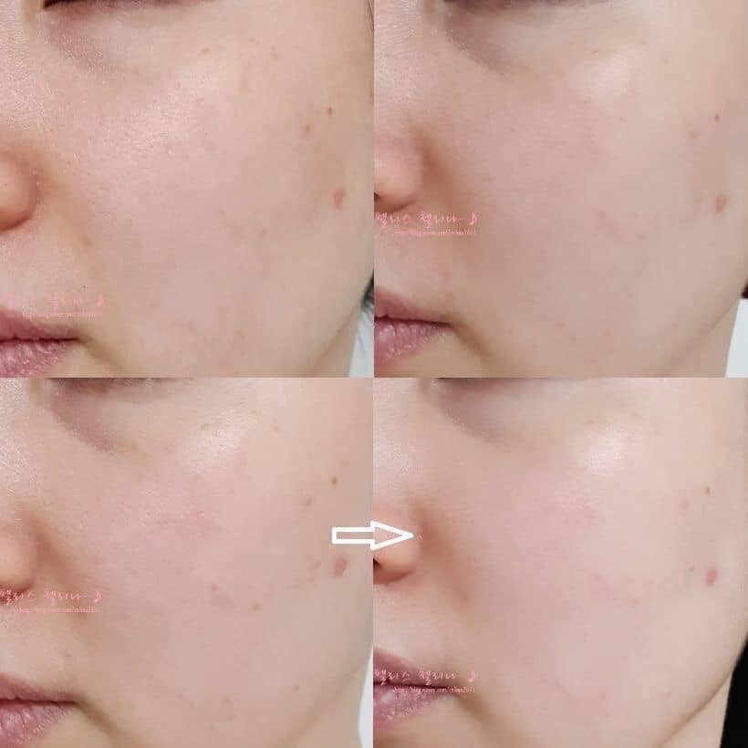 Tinh Chất Dưỡng Trắng, Giảm Lão Hóa Nuôi Dưỡng Làn Da Sáng Mịn Từ Bên Trong Some By Mi Galactomyces Pure Vitamin C Glow