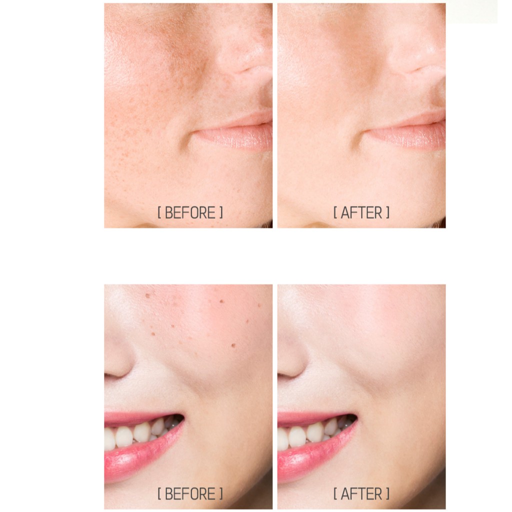 Che Khuyết Điểm Karadium Skin Perfection Concealer 2.2g | BigBuy360 - bigbuy360.vn