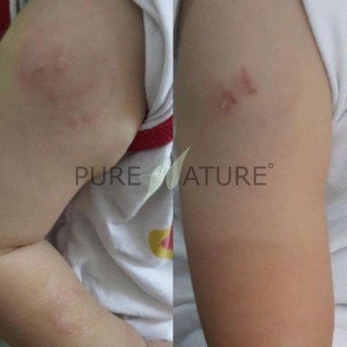 Combo Chăm Sóc Mẹ Và Bé Toàn Diện Sau Sinh